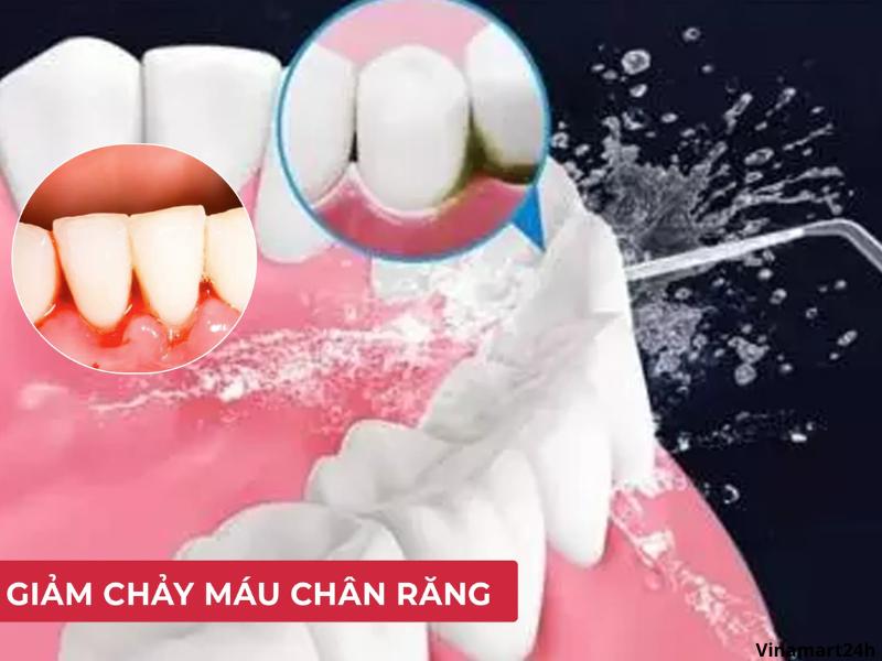 Sử dụng tăm nước bị chảy máu chân răng có sao không