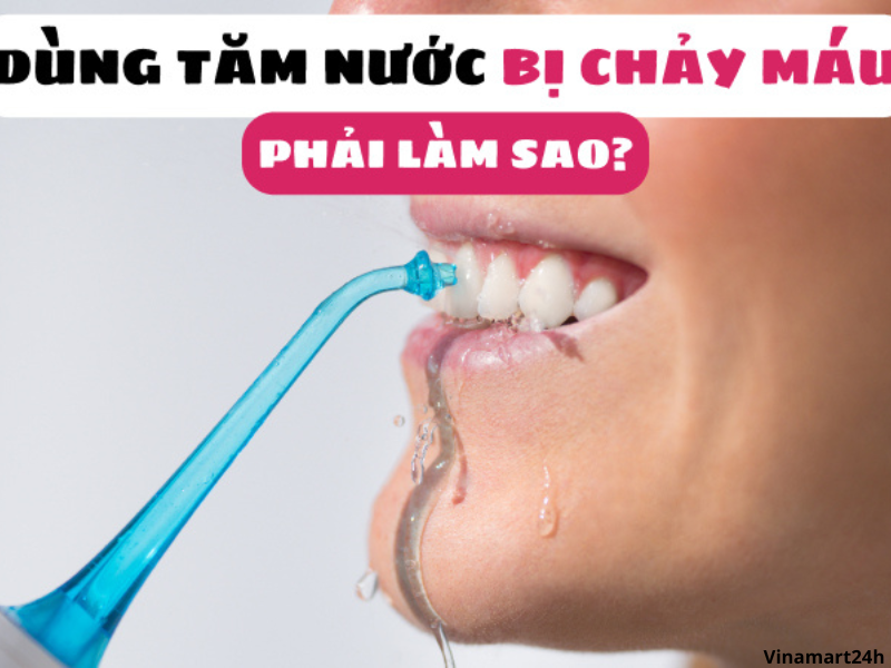 Lần đầu sử dùng tăm nước không quen