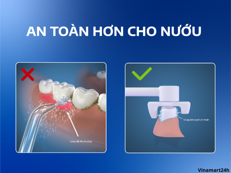  máy tăm nước 2 chiều Flossie